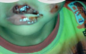 Mujer quemó a su hijo